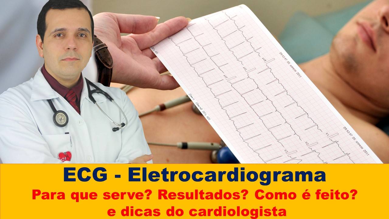 ECG - eletrocardiograma