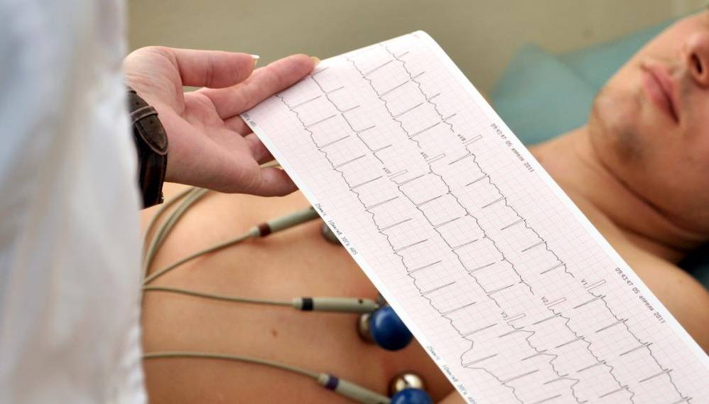 eletrocardiograma ECG Manaus