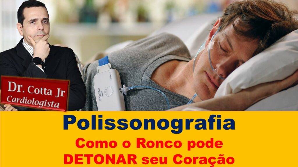 polissonografia apneia do sono hipopineia AHOS ronco Manaus