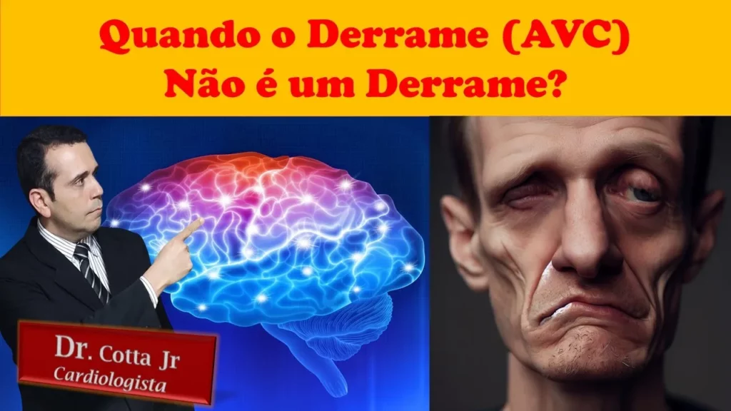 paralisia facial AVC AIT derrame diferença